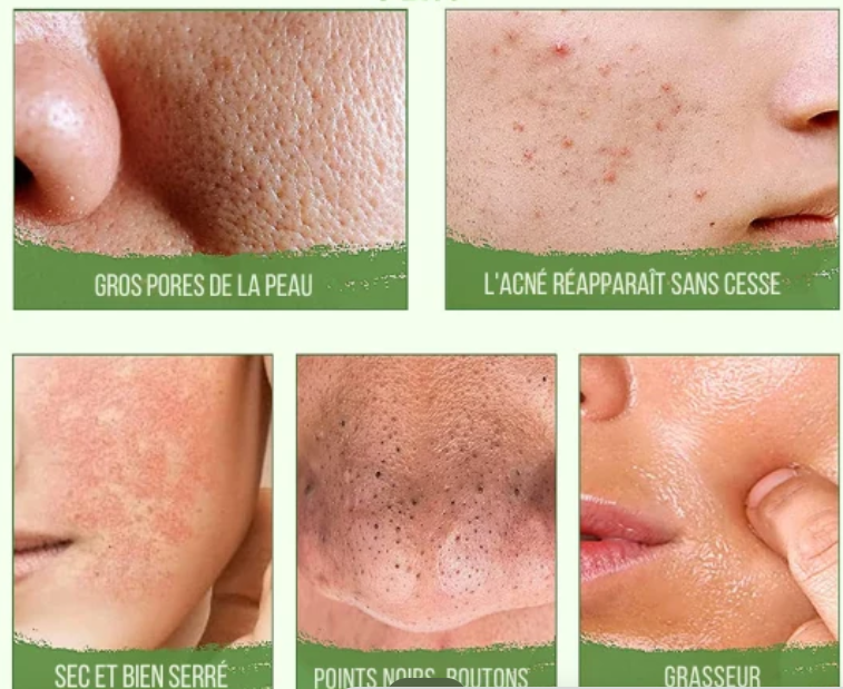 GREEN MASK STICK